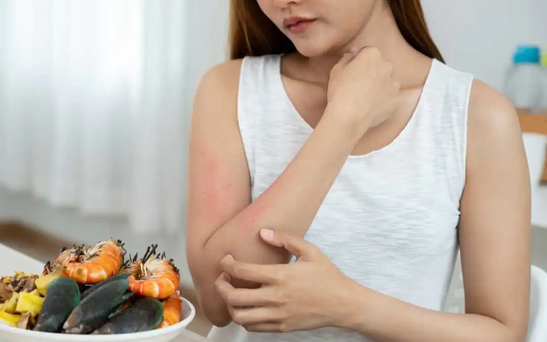 When to Get an Allergy Test: Signs You Shouldn’t Ignore