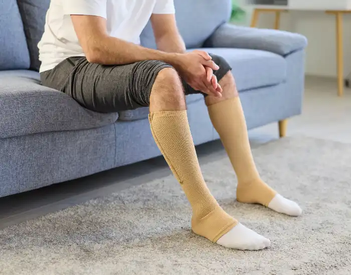Compression Socks and Varicose Veins