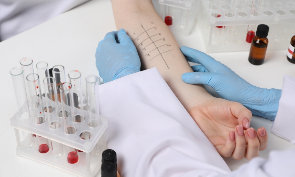 Patient receiving seasonal allergy evaluation and allergy testing at a primary care clinic in Round Rock Texas